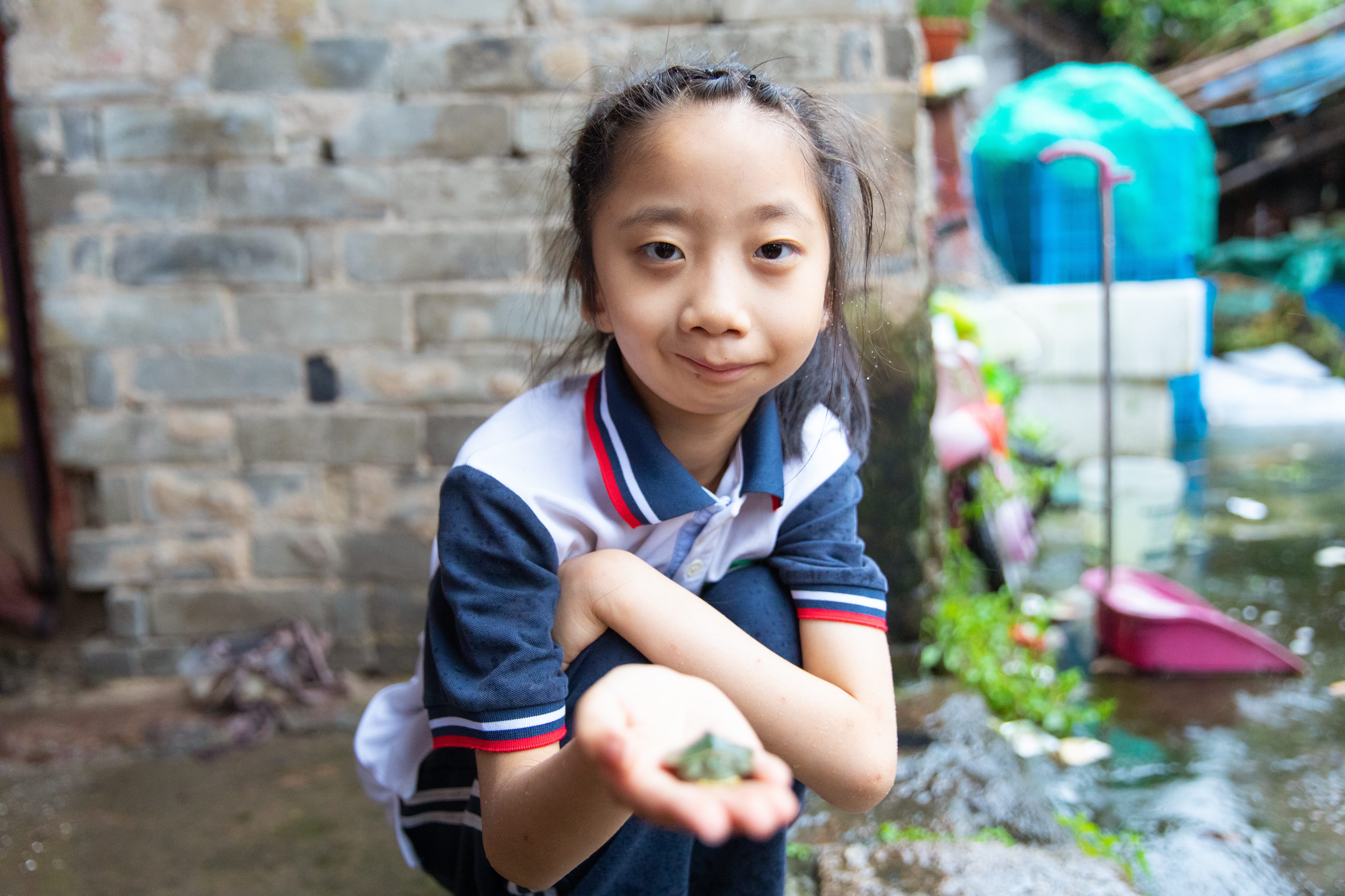 八年間三次手術(shù) 先天性“無嘴”小孩的重建人生